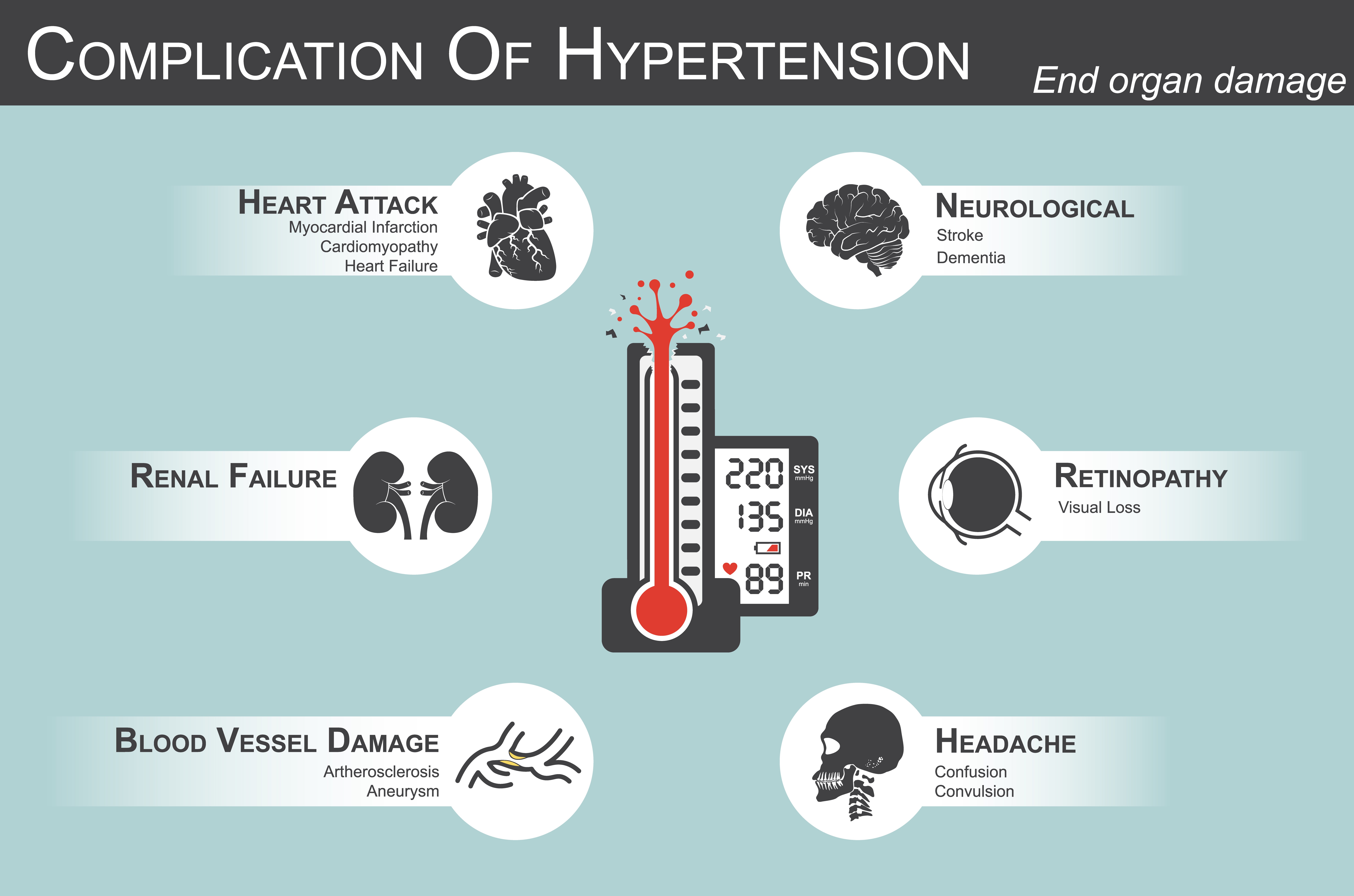 causes of high blood pressure