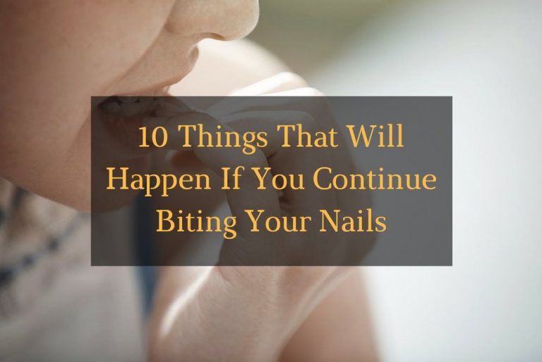 10 Things That Will Happen If You Continue Biting your nails